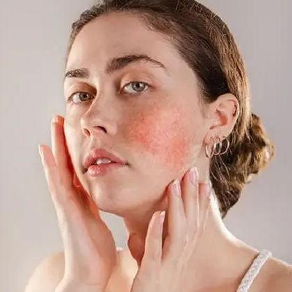 نکاتی که باید برای آرایش پوست حساس بدانید